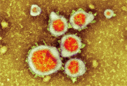 Вирусная инфекция у новорождённого увеличивает риск появления астмы у взрослого